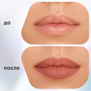 Прочее изображение